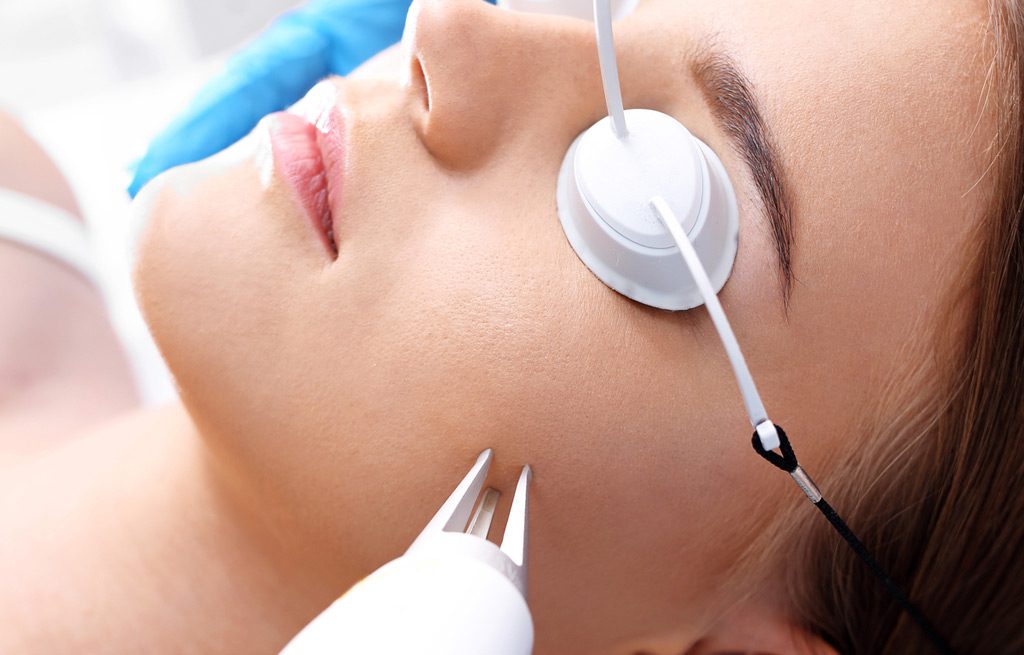Best-Laser-for-Acne-Scars-Silicon-Valley-Med-Spa-2