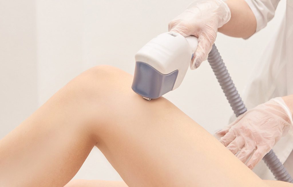 IPL-Hair-Removal-Silicon-Valley-Silicon-Valley-Med-Spa-1