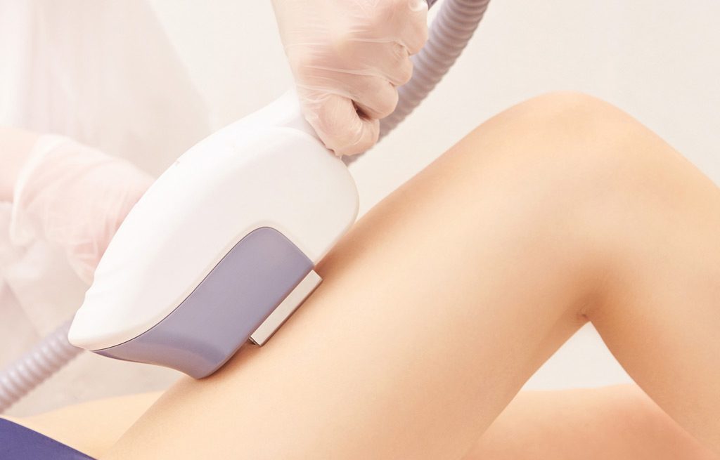 IPL-Hair-Removal-Silicon-Valley-Silicon-Valley-Med-Spa-3