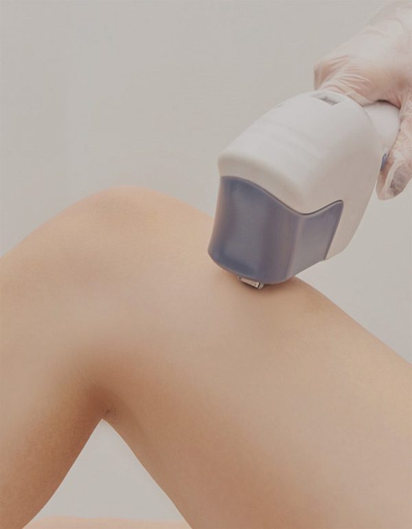IPL-Hair-Removal-Silicon-Valley-Thumb