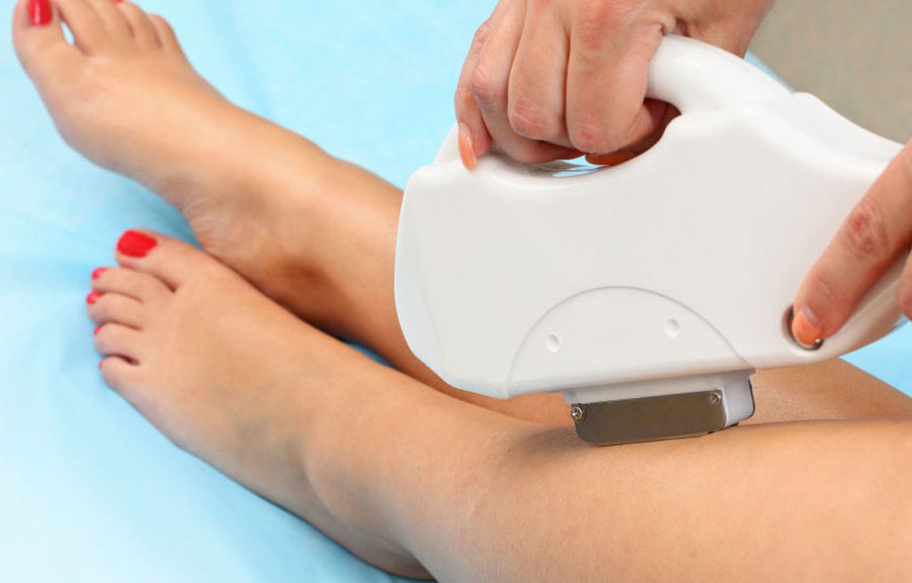 Laser-Vein-Removal-Silicon-Valley-Medical-Spa-3