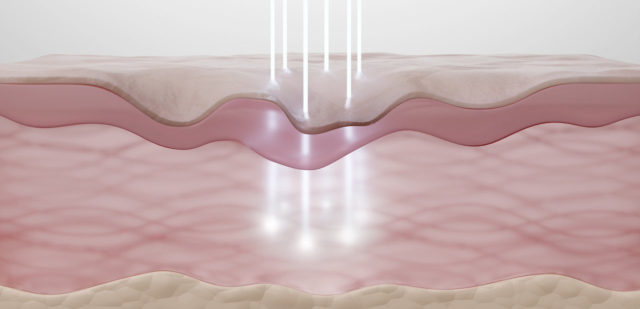 illustration of energy passing through the layers of skin